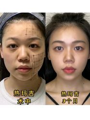 -丰联丽格医疗美容·联合丽格眼整形中心