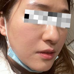 点击看大图 体验后-北京爱育华医院-医疗美容科