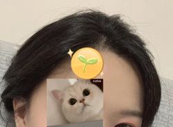 -大麦微针植发全国连锁