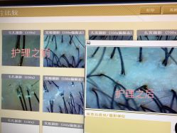 -丝客富脱发养发头皮馆