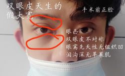 -上海时光整形外科医院