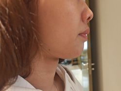 -四川米兰柏羽医学美容医院