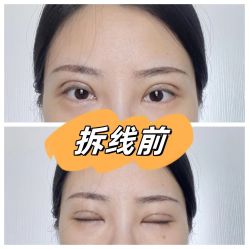 -素美医疗美容·西南眼鼻整形·修复基地
