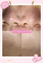 -E.beauty驻颜·痘敏肌调理中心