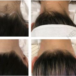 -HEYAN荷妍专业脱毛连锁机构