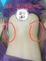 -兰州舒馨精致月子中心