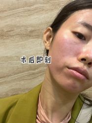 -海峡医疗美容医院