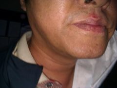 5月19日被门办费文轶拳殴的病人-上海中医药大学附属曙光医院(东部)