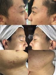 -皇族养心堂·净痘·修敏·御颜