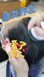 -大麦微针植发全国连锁