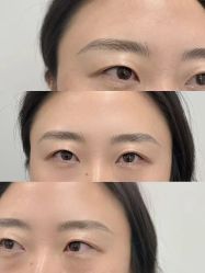 点击看大图 -张小野·专业半永久纹眉