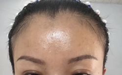 点击看大图 -SKIN79皮肤管理中心