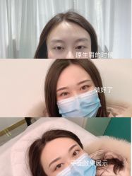 -久匠半永久纹眉