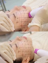 -上海漾颜医疗美容
