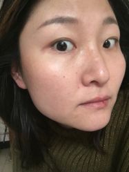 -北京美痣堂古方祛痣斑疣瘊