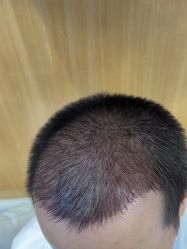 -雍禾植发