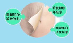 iphone_upload_pic-美丽妈妈产后恢复中心(城西力盟国芳店)