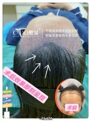 -熙朵美学植发·连锁品牌