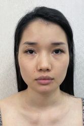 -广州曙光医学美容医院