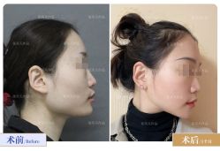 -圣嘉新医疗美容医院