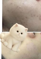 -蕾特恩专业祛痘·皮肤管理