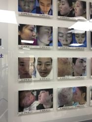 点击看大图 -痘博士北京·全国连锁祛痘机构