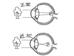 -无界眼镜MaxLess(滨江星光大道店)