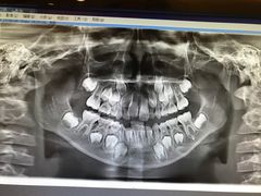 -天使口腔门诊部(上海店)