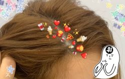 -大麦微针植发全国连锁