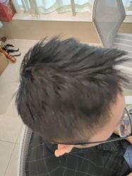 点击看大图 -碧莲盛·不剃发植发