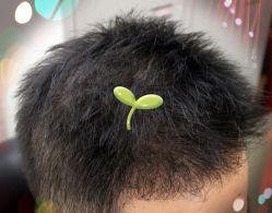 -大麦微针植发全国连锁