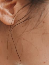-美瑞莎创美医疗美容