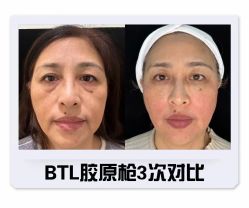 -LUNA皮相美·骨相美高级美感