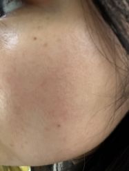 点击看大图 体验前-广州美莱医疗美容医院