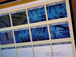 -丝客富脱发养发头皮馆