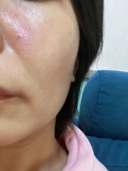 -北京美痣堂古方祛痣斑疣瘊