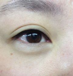 韩式美瞳线.刚做好哦！-平萍纹绣韩式半永久定妆