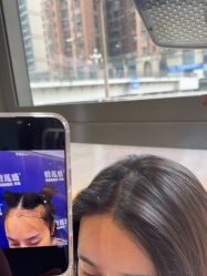 -碧莲盛·不剃发植发