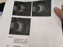 -浙江大学医学院附属第二医院眼科中心