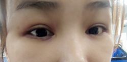 体验后-上海首尔丽格医疗美容医院