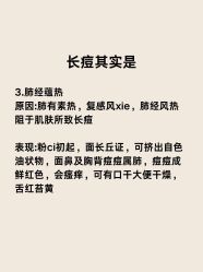 -克丽缇娜