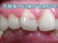 -团圆口腔·种植中心(锦江院区)