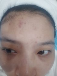点击看大图 -玫莉蔻皮肤管理中心