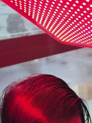 -碧莲盛·不剃发植发