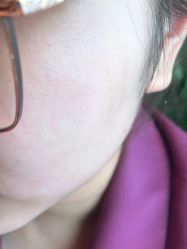 -丽美妍医疗美容·皮秒·立体分层抗衰