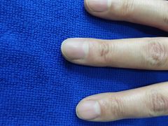 -世龙世家甲沟炎·灰指甲·嵌甲矫正·修脚(武侯区双楠店)