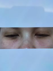 -Yestar 嘉兴艺星医疗美容医院