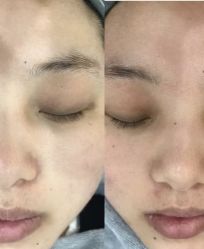 -SKIN79皮肤管理中心