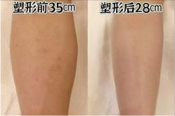 -Lily纤美·科技减脂中心