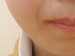 -华西牙科·四川口腔医院